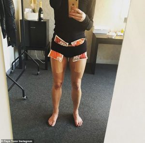 Photo shot of lower body of Faye Tozer with ice packs held in place on her thighs by her panties due to a hip flexor injury while on Strickly Come Dancing 2018.